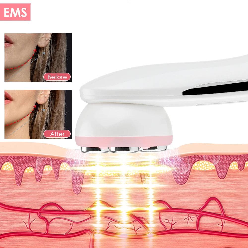 Aparelho Skin Care EMS, Radiofrequência Facial e LED - Cuidado Facial - 5 em 1