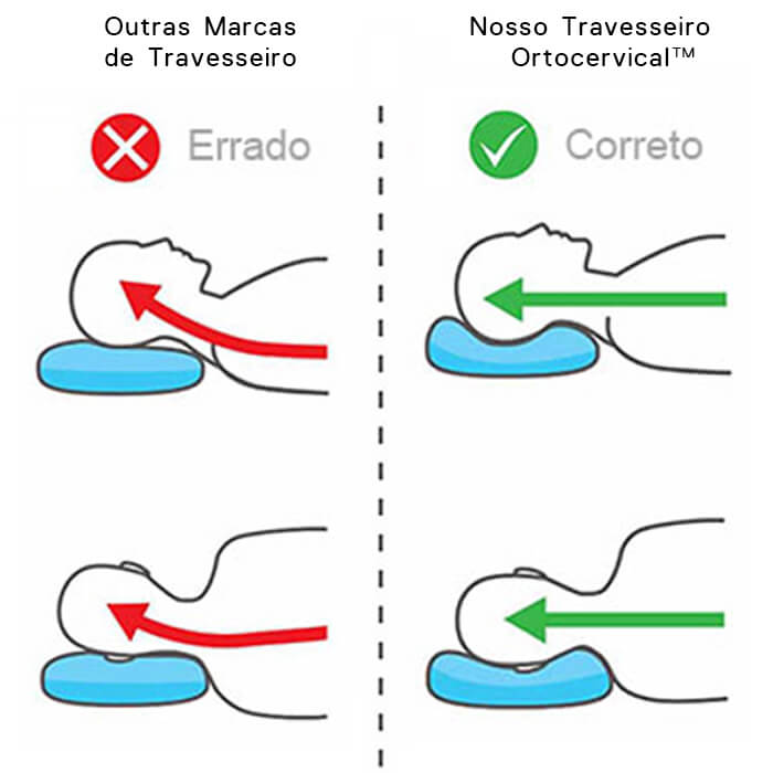 travesseiro para coluna cervical