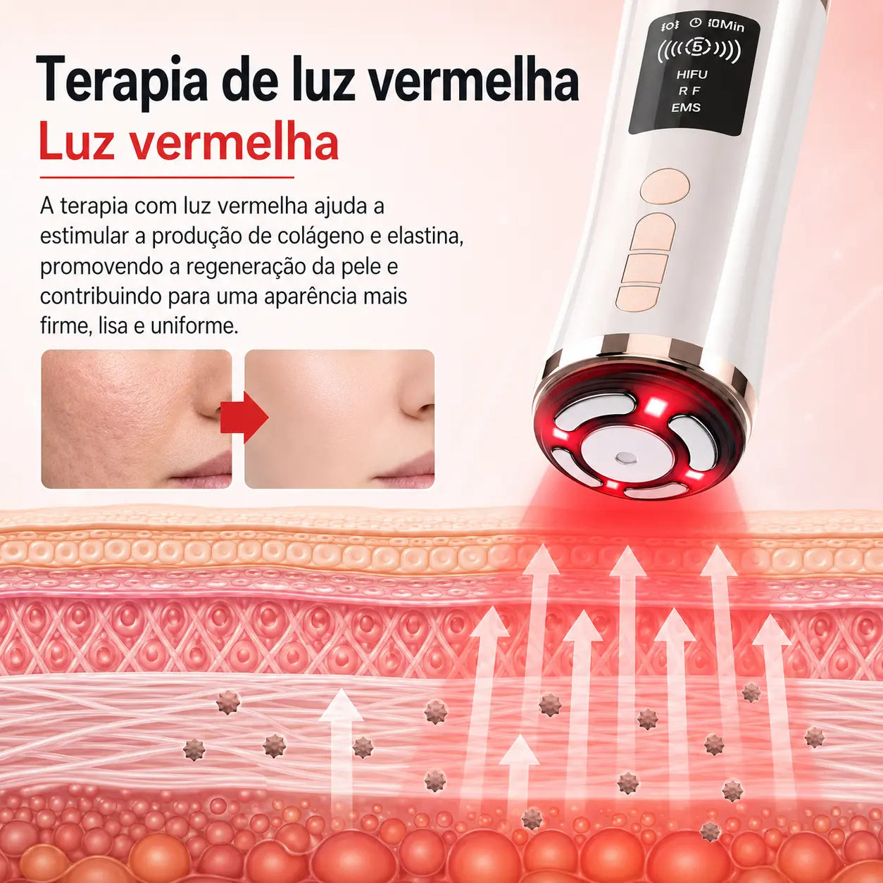 Massageador Facial HIFU e EMS com LED 3 Cores para Rejuvenescimento, Firmeza e Lifting Facial