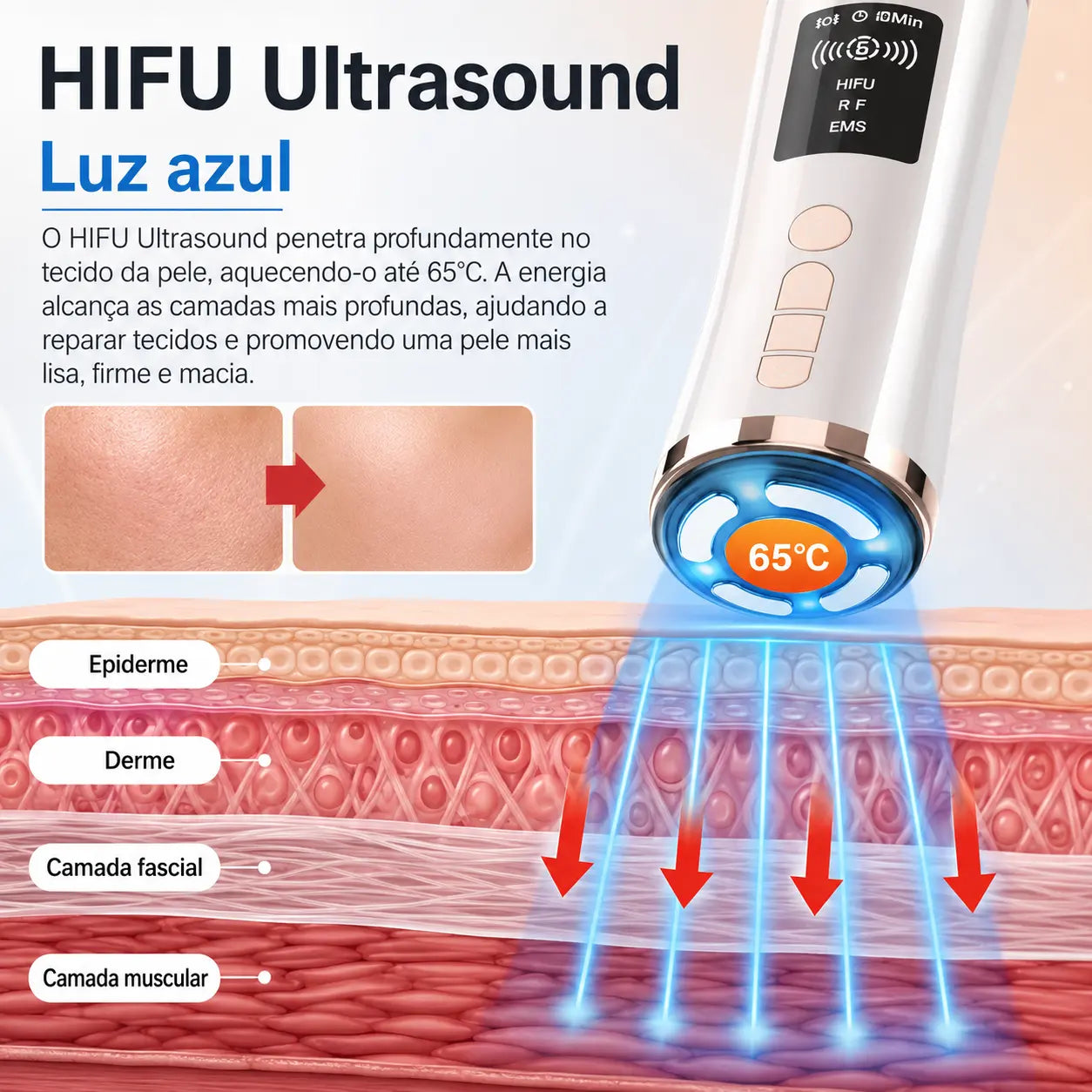 Massageador Facial HIFU e EMS com LED 3 Cores para Rejuvenescimento, Firmeza e Lifting Facial