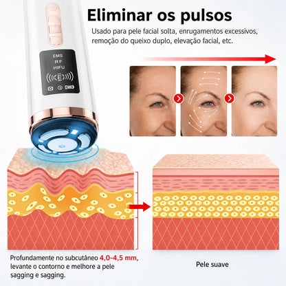 Massageador Facial HIFU e EMS com LED 3 Cores para Rejuvenescimento, Firmeza e Lifting Facial