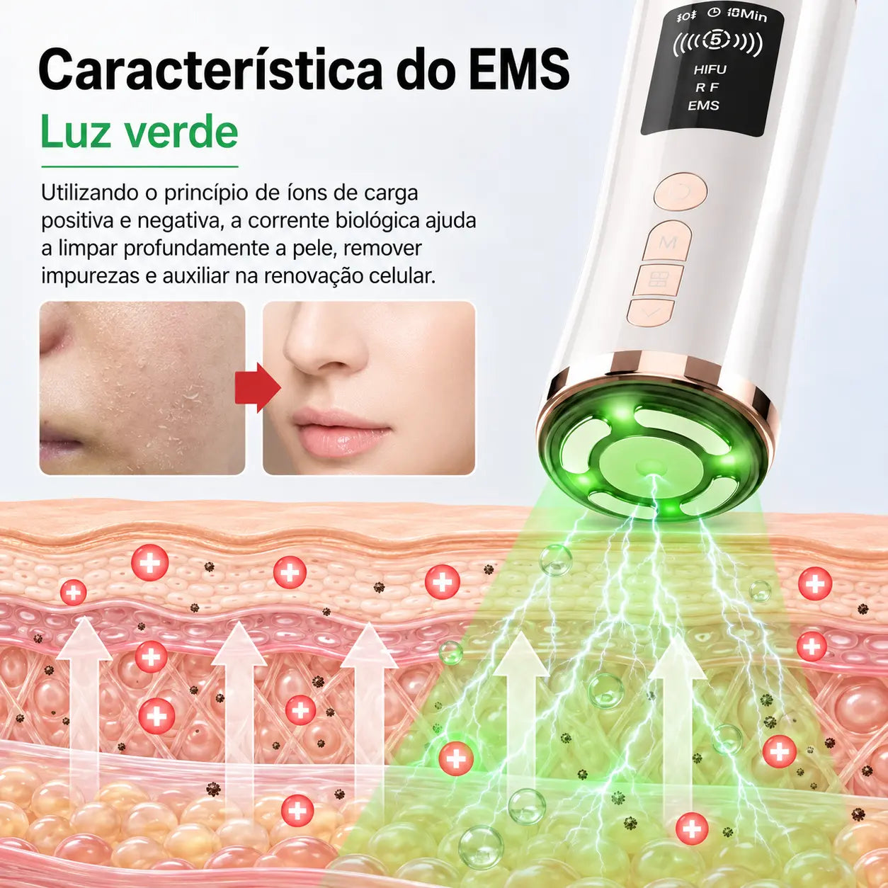Massageador Facial HIFU e EMS com LED 3 Cores para Rejuvenescimento, Firmeza e Lifting Facial