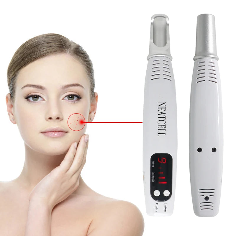 Neatcell Caneta Laser Removedora de Manchas