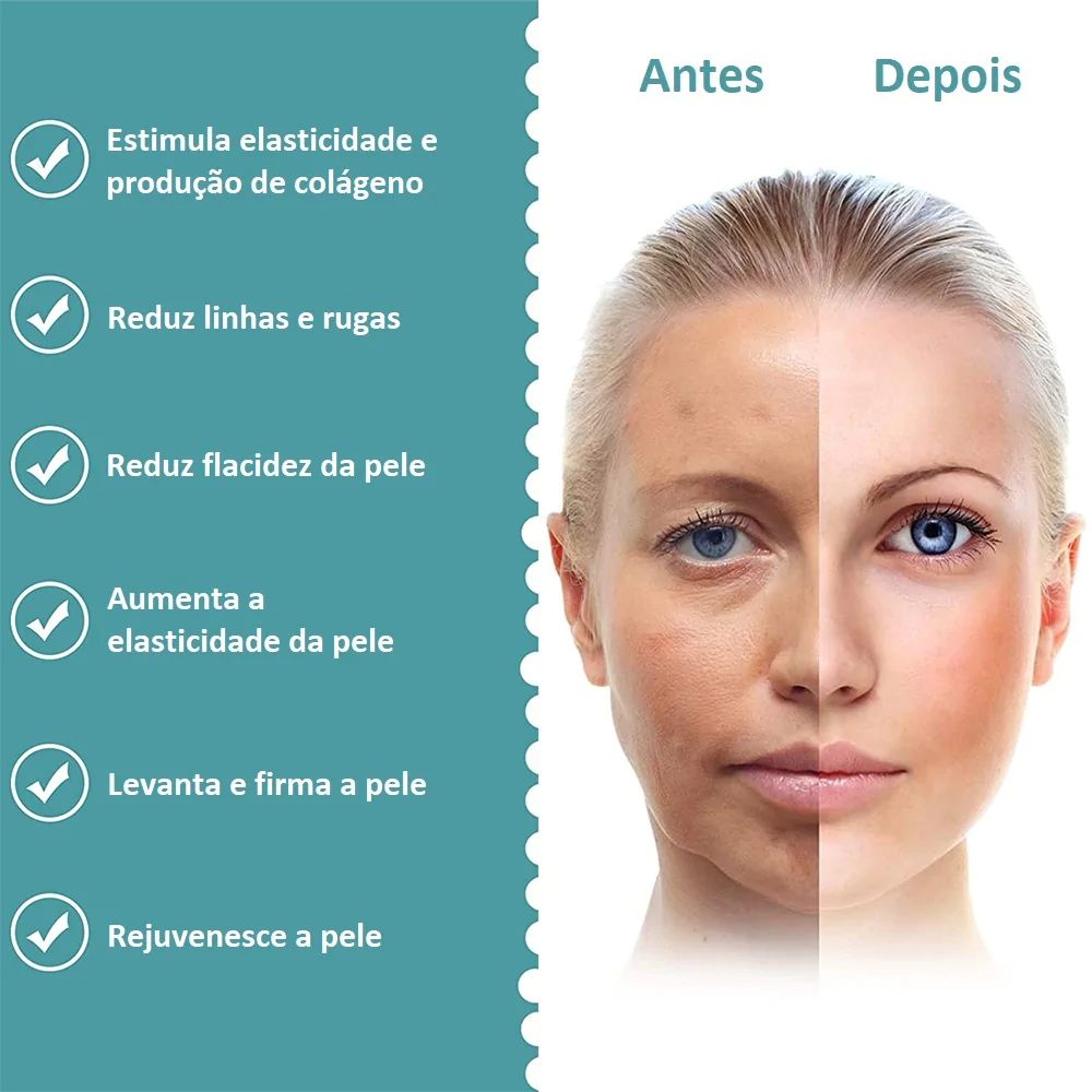 Aparelho Mini Hifu 2 Ultrassom Facial, Radiofrequência e EMS